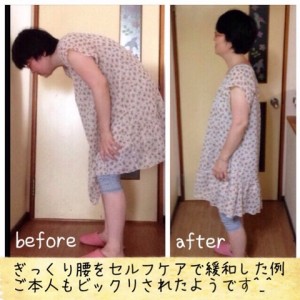 痛みに関してはギックリ腰だって、こんなに改善