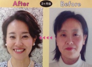 ダイエットやアンチエイジングも思いのまま